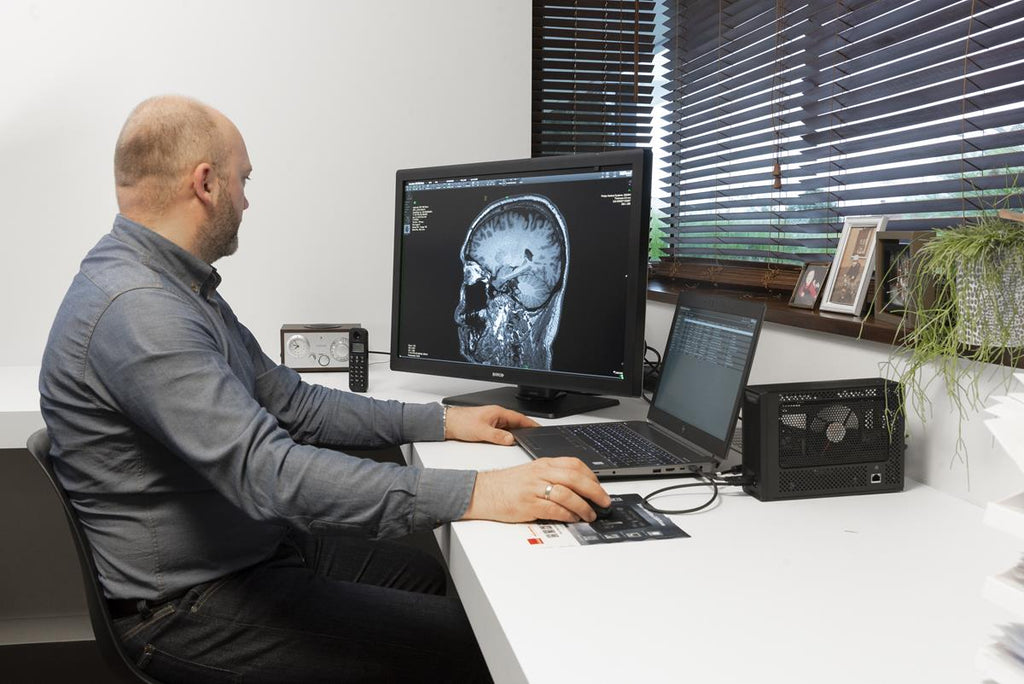 La fatiga ocular un problema a resolver en la radiología