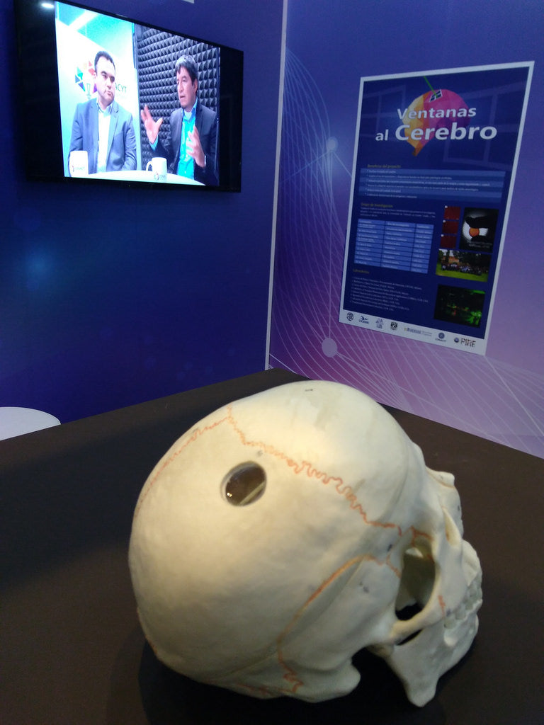 Investigadores de México y EU desarrollan una "ventana al cerebro" para diagnóstico y tratamientos no invasivos