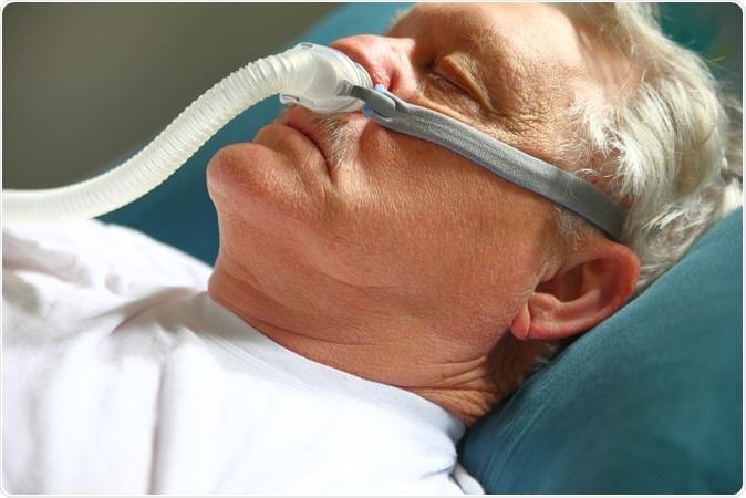 COVID-19 patients with sleep apnoea could be at additional risk