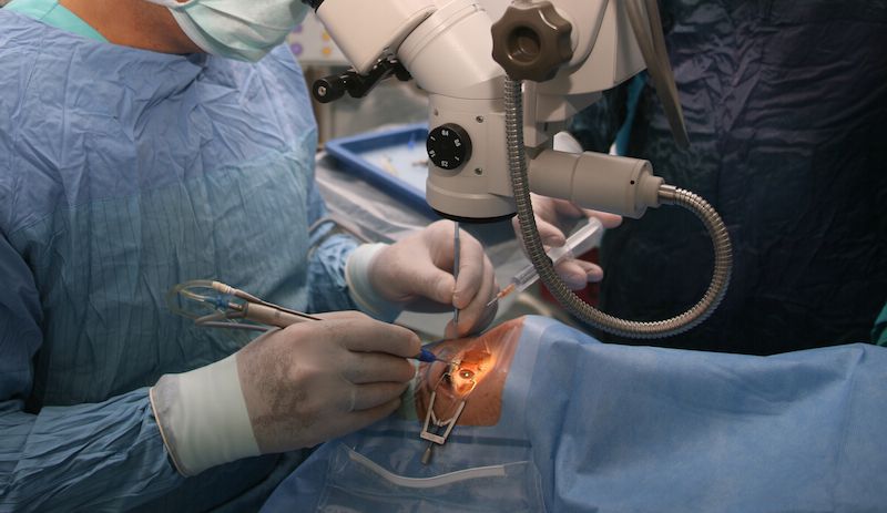 La APEC realizará 1000 cirugías de catarata a $10000 pesos