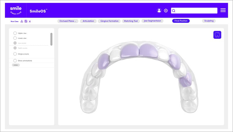 La impresión 3D ha permitido reducir los costos de producción en odontología