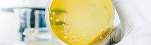 New data on Probi Defendum confirms probiotics supporting the immune system