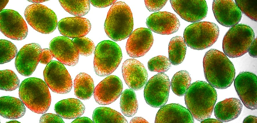 Usan modelos de cerebros en miniatura para un mejor conocimiento de la actividad cerebral