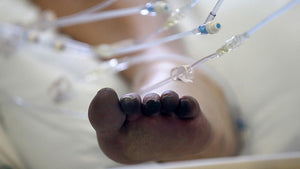 Are ‘COVID toes’ actually caused by the coronavirus?