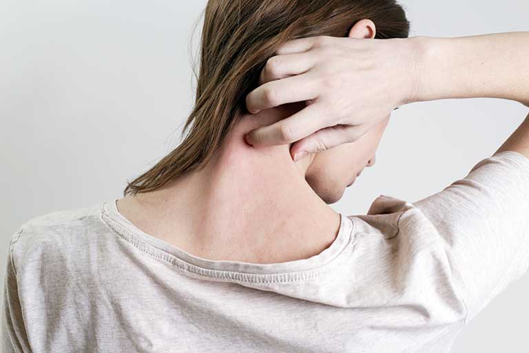 ¿Padeces dermatitis atópica?Conoce cuatro razones que podrían poner en riesgo tu estabilidad laboral